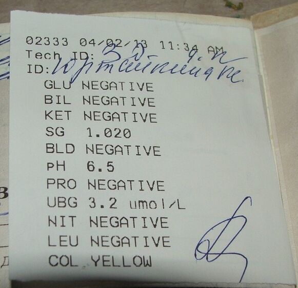 Moja analiza urina rezultira prije femixal